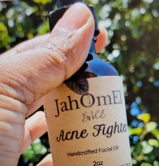 Acne Fighter Oil